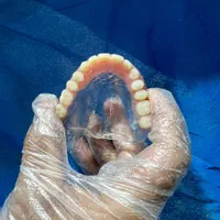 خدمات تخصصی پروتز متحرک(دندان مصنوعی)|خدمات آرایشگری و زیبایی|قزوین, |دیوار