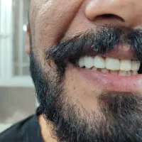 دندانسازی دنتوس