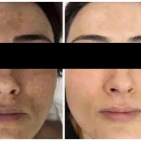 کرم گیاهی|آرایشی، بهداشتی، درمانی|آستارا, |دیوار