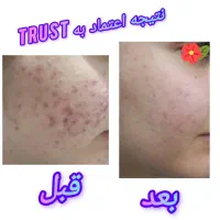 مشاورتخصصی پوست ومو|خدمات آرایشگری و زیبایی|شیراز, دارالرحمه|دیوار