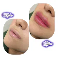تخفیف ویژه جشنواره تابستانه مطب زیبایی دکتر شمشیری|خدمات آرایشگری و زیبایی|اردبیل, |دیوار