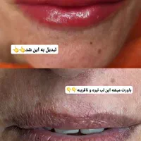 تخفیف یلدایی ۸۸۰ شیدینگ لب تضمین بدون درد|خدمات آرایشگری و زیبایی|دورود, |دیوار