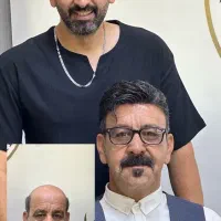 پروتزمو پروتز مو VIP تغییر چهره در چند ساعت|خدمات زیبایی و سلامت|تهران, دیلمان|دیوار