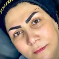 فیبروز تخصصی