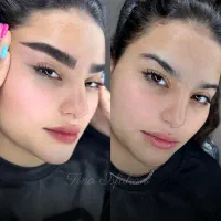 آفر فوق العاده استثنایی برای میکرولیفت و شیدینگ لب