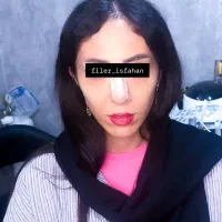 فیلر ،بوتاکس ، مزو ، مزوژل مدل|خدمات آرایشگری و زیبایی|اصفهان, سعادت‌آباد|دیوار