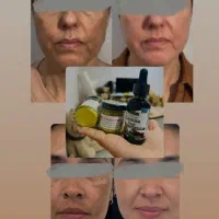 کرم دالفورداصل فرانسه ضدلک قوی بارداری وسفیدی پوست|آرایشی، بهداشتی، درمانی|تهران, اتحاد|دیوار