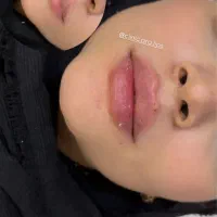 ژل/بوتاکس/مزو ژل/وآموزش|خدمات آرایشگری و زیبایی|خرمشهر, |دیوار