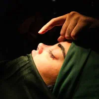 جراحی و عمل زیبایی بینی