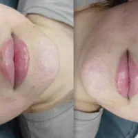خدمات ژل وبوتاکس وتتو