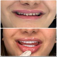 دندانپزشکی قسطی در مطب لنگرود|خدمات آرایشگری و زیبایی|لاهیجان, گلستان|دیوار
