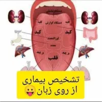 سونوی رایگان از بدن