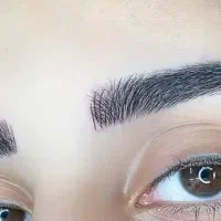 مدل میکروبلیدینگ