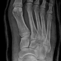 رادیولوژی و سونوگرافی در منزل تهران و کرج|پزشکی|تهران, ونک|دیوار