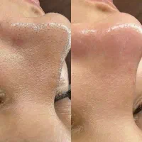 کلیه خدمات پوست و فیشیال تخصصی با بهترین متریال