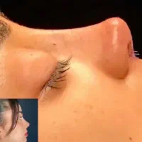 عمل جراحی زیبایی بینی.لیفت صورت.اندام