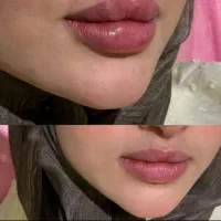پوست،مو،زیبایی (کلینیک نچرال بیوتی)|خدمات زیبایی و سلامت|اصفهان, جلفا|دیوار