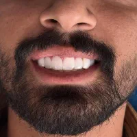 کامپوزیت 20تومن|خدمات آرایشگری و زیبایی|دورود, |دیوار