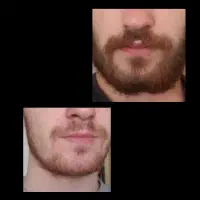 پکیج رویش مو و ریش ( ارسال سراسر کشور )