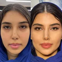 تخفیف به مناسبت روز مادر /ژل لب- کانتورینگ- بوتاکس|خدمات آرایشگری و زیبایی|مشهد, ایثار|دیوار