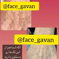 بزرگترین غول ۸کاره جهان|آرایشی، بهداشتی، درمانی|شیراز, کفترک|دیوار