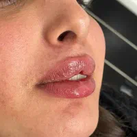 خدمات زیبایی و بلفارو‌ پلاستی و جراحی توسط پزشک