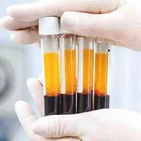 تخفیفات پی ار پیPRP مو و صورت