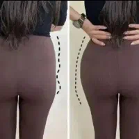 تخفیفات فیلر بادی ،بوتاکس،کانتورینگ توسط پزشک|خدمات آرایشگری و زیبایی|کرج, گوهردشت|دیوار