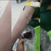 حجامت ،بادکشی (گرم وسرد) وفصد|خدمات آرایشگری و زیبایی|اهواز, شهرک دانشگاه|دیوار