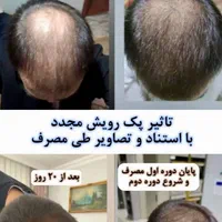 مشاوره ریزش مو و رویش مجدد|خدمات آرایشگری و زیبایی|مشهد, کلاهدوز|دیوار