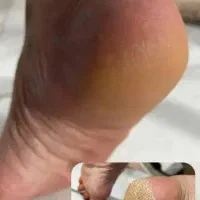 پدیکور ، لیفت مژه و ابرو