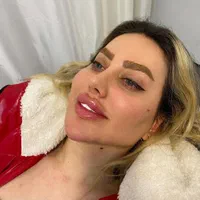 تزریق ژل و بوتاکس لیفت نخ جدیدترین متد مطب زیبایی|خدمات آرایشگری و زیبایی|کرج, گوهردشت|دیوار