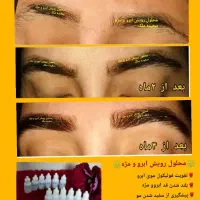 محلول رویش و رشد مجدد ابرو و مژه|آرایشی، بهداشتی، درمانی|مشهد, موسوی قوچانی|دیوار