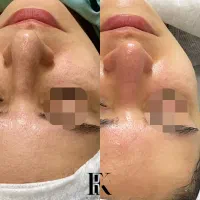 فیشال / پاکسازی پوست