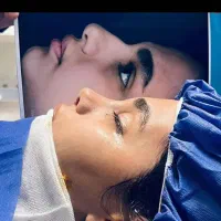 اف عمل بینی22ملیون