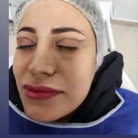 بلفاروپلاستی،لیفت ابرو،لیفت شقیقه،دایرکت ابرو|خدمات آرایشگری و زیبایی|ارومیه, |دیوار