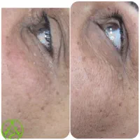اموزشگاه ومرکز تخصصی پوست|خدمات آموزشی|زرند, |دیوار