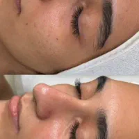 فیشیال تخصصی وپاکسازی پوست