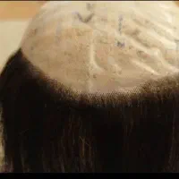 بافنده پروتز مو (دورکاری)|استخدام درمانی، زیبایی، بهداشتی|اصفهان, سعادتآباد|دیوار