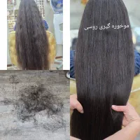 موخوره گیری تخصصی و اسپا فروش دستگاه شیکلم