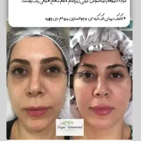 فیشال /کاموفلاژ/bbglow/میکروکارنت