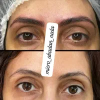 میکروبلیدینگ ابرومیکروپبکمنتش