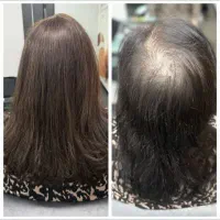 مو طبیعی به سبک جدید msh