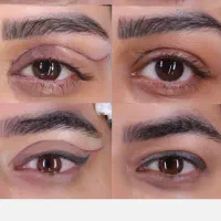 بلفارو پلاستی