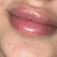 آفر ویژه با دوستات بیا زیبایی