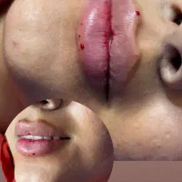 ارائه خدمات کراتین،ژل و بوتاکس،پاکسازی و فیشیال