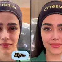 کلینیک تخصصی ژل و بوتاکس|خدمات آرایشگری و زیبایی|شاهین‌شهر, فردوسی|دیوار