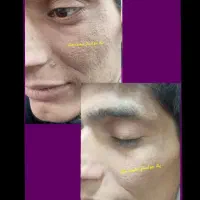 پک جوانساز بیست کاره سعیده ملک|آرایشی، بهداشتی، درمانی|بافق, |دیوار