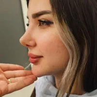 تخفیف زیبایی بینی ۲۸ت دراهوازتااخرماه فقط
