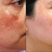 سلام روغن های خوراکی ورق بزنید|آرایشی، بهداشتی، درمانی|محمدیه-قزوین, |دیوار